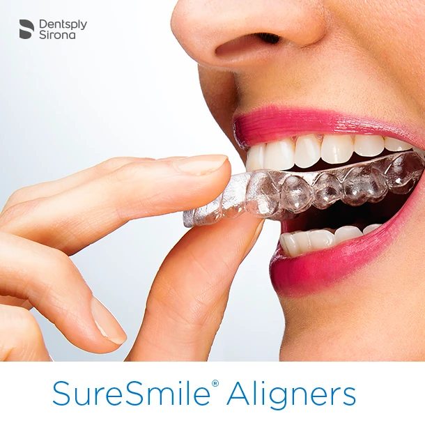Ortodoncia invisible con alineadores — Dental Carriches
